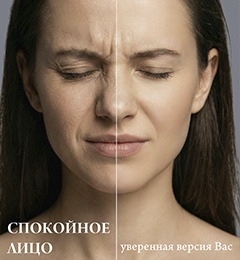 Ботулинотерапия